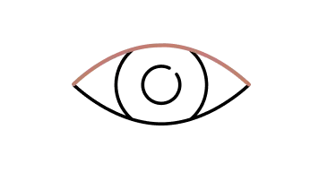 Monolids (Single Eyelids)